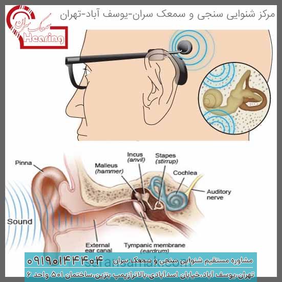 سمعک استخوانی چیست؟