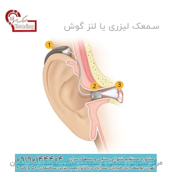 لنز گوش نازک سیلیکونی